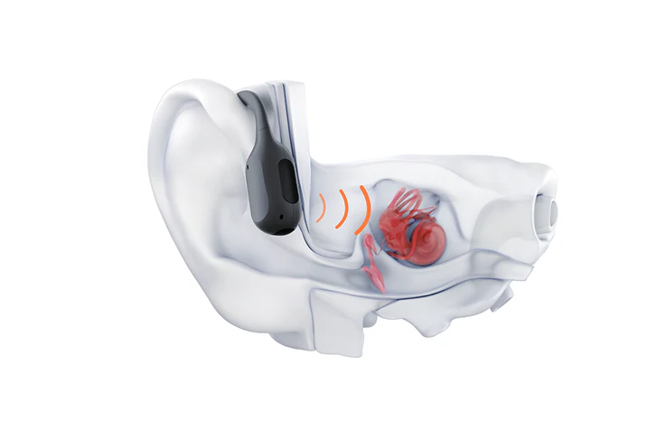 how shokz bone conduction works