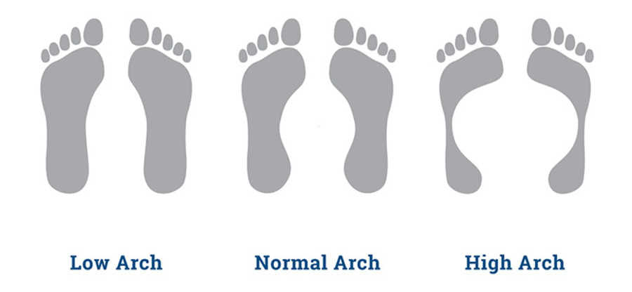 types-of-feet